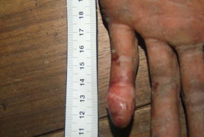 Vụ án mạng nạn nhân và hung thủ đều câm điếc ảnh 2