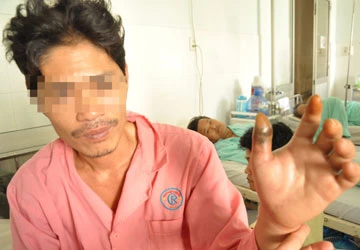 Bi hài chuyện rắn cắn ảnh 1 Bi hài chuyện rắn cắn ảnh 1