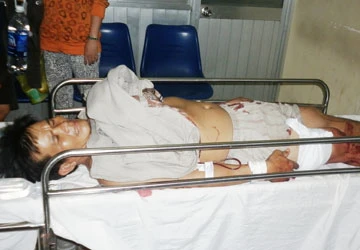 Mất mối làm ăn, giang hồ truy sát “hiệp sĩ” ảnh 1