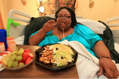 Máy chụp não "chê" người phụ nữ béo nhất thế giới ảnh 1