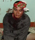 Bé gái 5 tuổi bị kẻ trộm chó bắt làm con tin ảnh 1