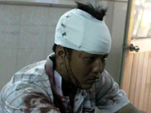 Cãi vã, đâm đồng nghiệp hơn chục nhát dao ảnh 2