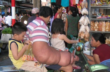 Chuyện về người đàn ông có cánh tay to nhất Việt Nam ảnh 2