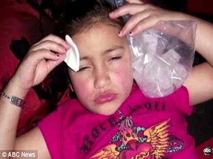 Sốc với bà mẹ tiêm botox vào mặt bé gái 8 tuổi ảnh 3
