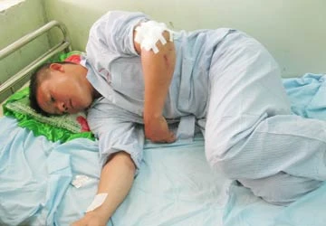 Lâm tặc truy sát, một bảo vệ rừng trọng thương ảnh 1