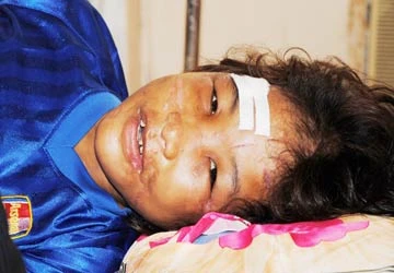 Vụ bé Hào Anh ở Cà Mau bị hành hạ dã man: Phải tính thêm thiệt hại phi vật chất ảnh 1