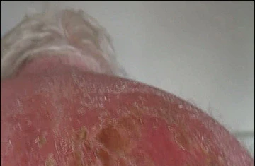 Khách hàng “tố” ghế sofa chứa hoá chất gây bỏng da ảnh 1