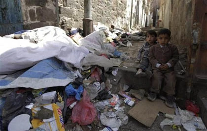 Những đứa trẻ teo tóp đáng thương ở Yemen ảnh 13