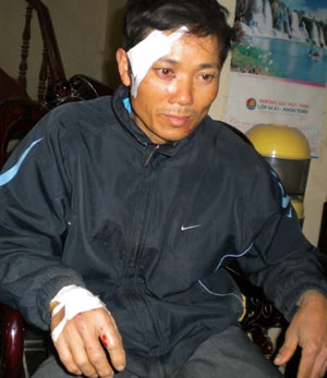 Nghệ An: Sập mỏ đá, 18 người chết, sáu người bị thương nặng ảnh 3 Nghệ An: Sập mỏ đá, 18 người chết, sáu người bị thương nặng ảnh 3