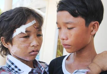 Vụ em trai 14 tuổi bị hành hạ ở Cà Mau: Ký ức tuổi thơ quá buồn… ảnh 1 Vụ em trai 14 tuổi bị hành hạ ở Cà Mau: Ký ức tuổi thơ quá buồn… ảnh 1