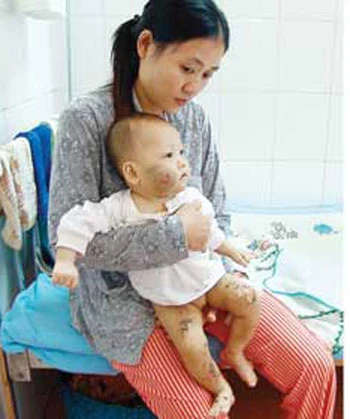 Bé 9 tháng tuổi bị đánh dã man ảnh 1