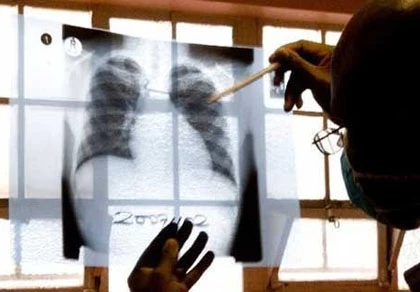 Vì sao các bác sĩ bị hút về Mỹ? ảnh 1 Vì sao các bác sĩ bị hút về Mỹ? ảnh 1