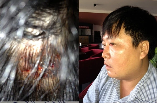 Bất thường vụ đại úy công an bị đánh trọng thương? ảnh 2