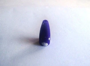 Cậu bé 7 tuổi xẹp phổi vì nuốt phải đầu bút bi ảnh 1