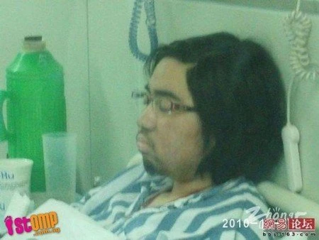 Uống thuốc mạnh, thiếu nữ mọc đầy râu, lông ảnh 4