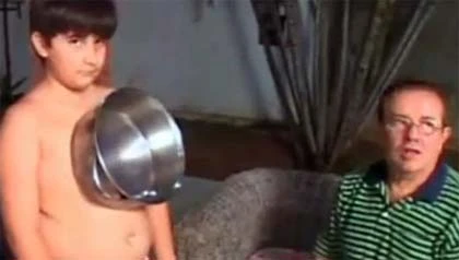 Gặp cậu bé hút kim loại như nam châm ảnh 2