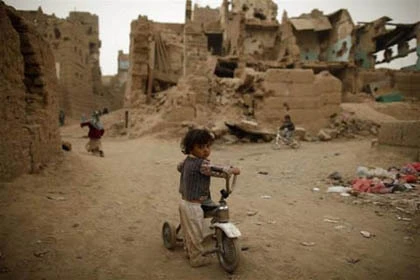 Những đứa trẻ teo tóp đáng thương ở Yemen ảnh 11