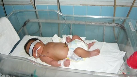 Sơ sinh nghi bị mẹ bóp mũi vứt vào thùng rác ảnh 1