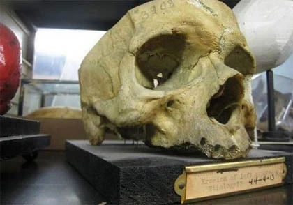 Bảo tàng rùng rợn nhất thế giới ảnh 7