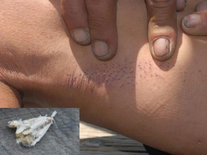 Ngứa phát điên vì bướm “lạ” ảnh 3