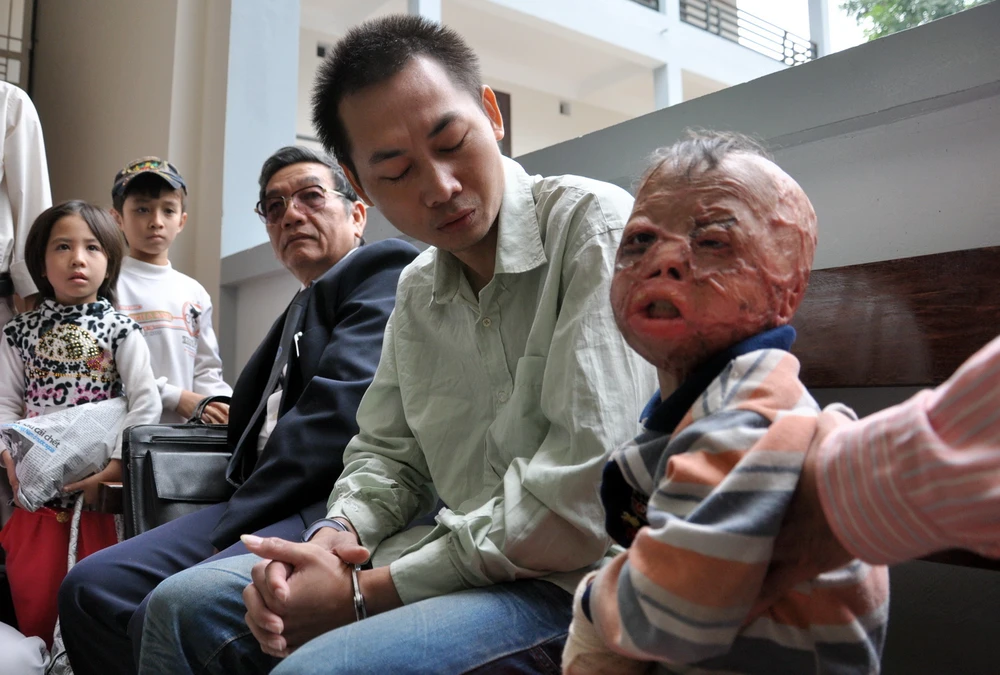 Chùm ảnh: Phiên tòa xét xử người cha nhẫn tâm đốt con mới ba tuổi ảnh 1