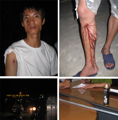 Nhân viên trạm thu phí đánh tài xế vì “tội mặc cả” ảnh 1