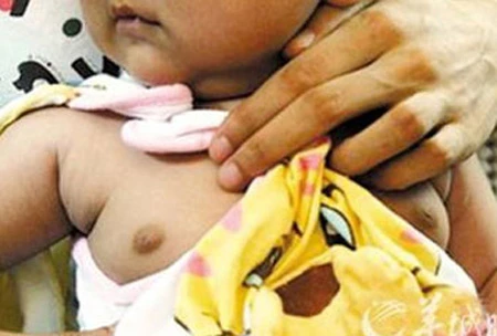 4 tuổi đã dậy thì vì thuốc tránh thai của mẹ ảnh 1