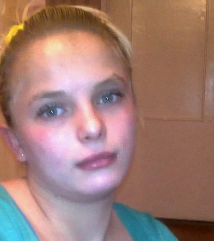 Ukraine phẫn nộ vụ cô gái bị cưỡng hiếp tập thể, bị đốt cháy ảnh 2 Ukraine phẫn nộ vụ cô gái bị cưỡng hiếp tập thể, bị đốt cháy ảnh 2