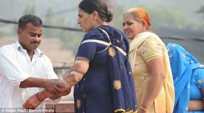 Xếp hàng dài để được rạch chân, tay ảnh 4 Xếp hàng dài để được rạch chân, tay ảnh 4