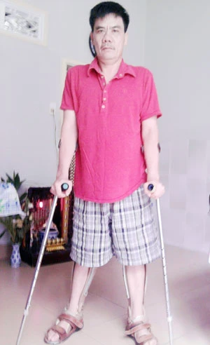 Kiện bác sĩ vì càng chữa càng liệt ảnh 1