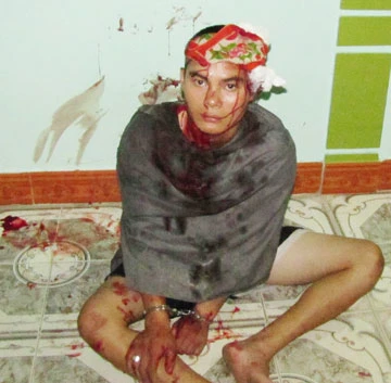 Nạn trộm chó và những chuyện đau lòng - Bài 2: Khi sự phẫn uất thành cái ác ảnh 2