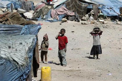 Những đứa trẻ teo tóp đáng thương ở Yemen ảnh 6