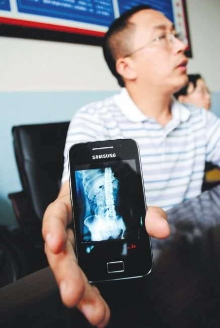 Bác sĩ quên vải xô trong bụng sản phụ ảnh 1