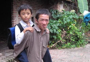 Bố tâm thần vẫn cần mẫn cõng con tới trường ảnh 1