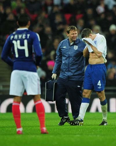 Gerrard chấn thương, Liverpool được bồi thường 500.000 bảng ảnh 1