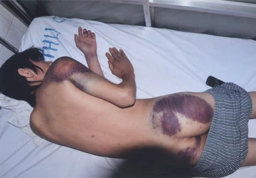 Bị công an đánh khi báo tin cướp xe? ảnh 1