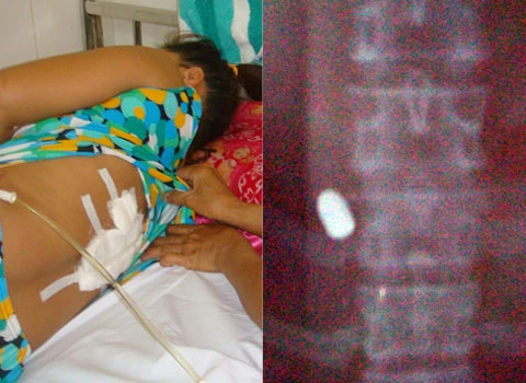 2 phụ nữ bị súng cảnh sát bắn trọng thương ảnh 2