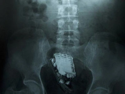 Điện thoại reo trong bụng tù nhân ảnh 1 Điện thoại reo trong bụng tù nhân ảnh 1