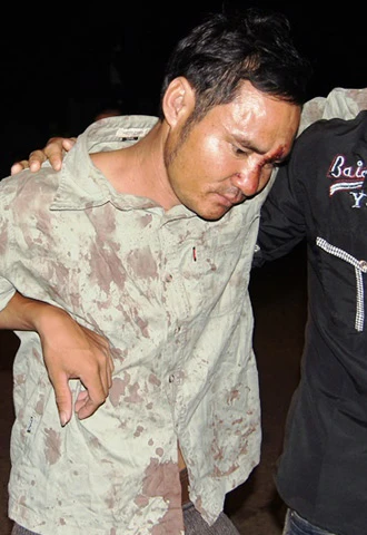 "Côn đồ xông vào trụ sở công an đánh dân" ảnh 1