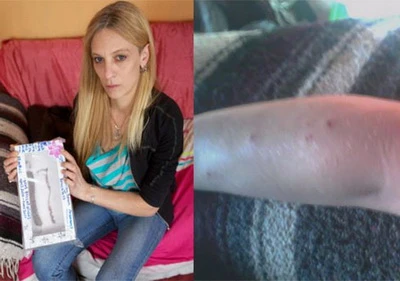 Suýt chết vì đeo vòng tay nhiễm chất cấm ảnh 2