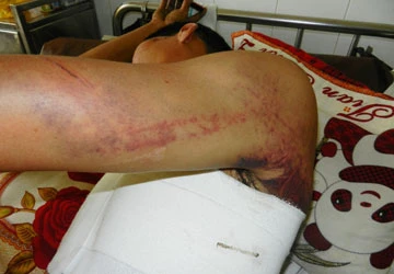 Dân phòng đánh người do nghi ăn trộm ảnh 1