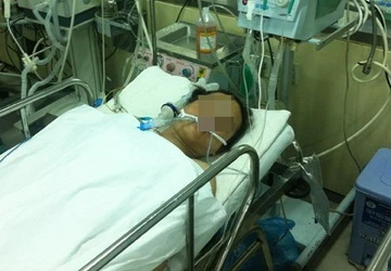 Nghệ sĩ xiếc đường phố nuốt kiếm làm thủng thực quản ảnh 1