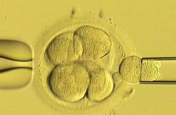 Trẻ sinh bằng ống nghiệm nguy cơ ung thư cao hơn ảnh 1