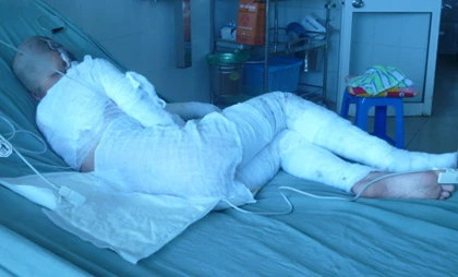 Buổi tối kinh hoàng của gia đình bị tạt axít ảnh 2