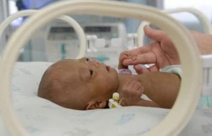 Bé sơ sinh có trái tim nhỏ như trứng cút ảnh 1