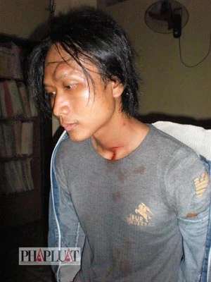 Chùm ảnh: Hiện trường vụ bắt cóc học sinh trường mầm non ảnh 24