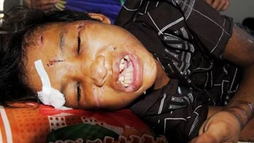 Vụ em trai 14 tuổi bị hành hạ dã man ở Cà Mau: Chủ trại tôm quá độc ác! ảnh 2 Vụ em trai 14 tuổi bị hành hạ dã man ở Cà Mau: Chủ trại tôm quá độc ác! ảnh 2