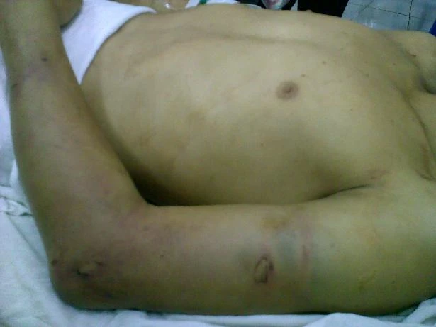 Sáu người dùng tuýp sắt, súng, gí điện hành hạ 1 cậu bé ảnh 2