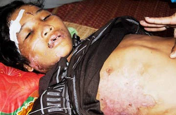 Bé Hào Anh bị bẻ răng, cắt môi: "Cuộc chơi hả hê" của vợ chồng Giang - Thơm? ảnh 1