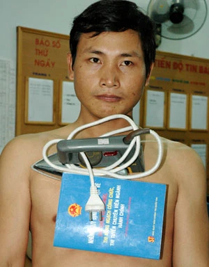 Những vụ “tự cháy” do… hộp quẹt ảnh 3